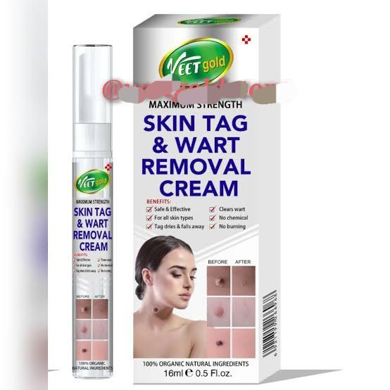 Veet gold Skin Tag & Wart Removal Cream (16ml)